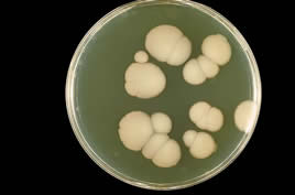 800px-Candida albicans PHIL 3192 lores